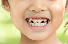 child tooth misalignment headaches